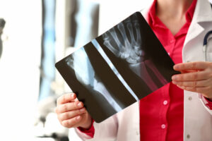 What Is the Function of Your Musculoskeletal System?