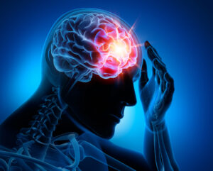 Can I Get Compensation If I’m Blamed For the Accident That Caused My Brain Injury?