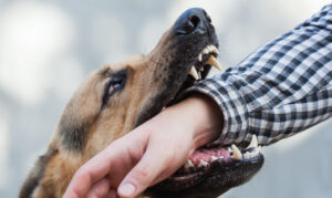 How Can a Dog Bite Lawyer Help Me?